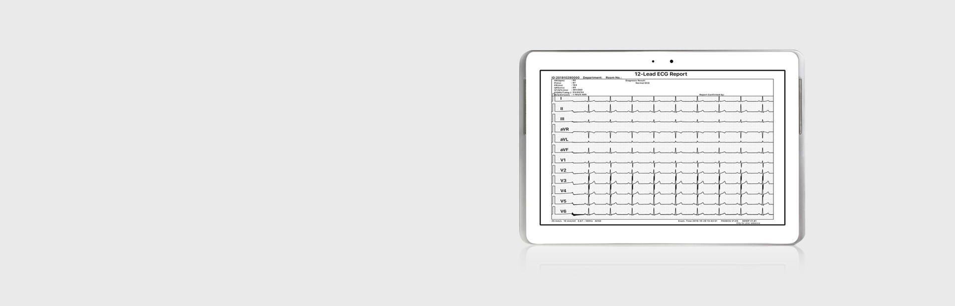 Report Edit and Output