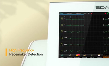Pacemaker Essentials: Accurate Detection in Pacing ECG