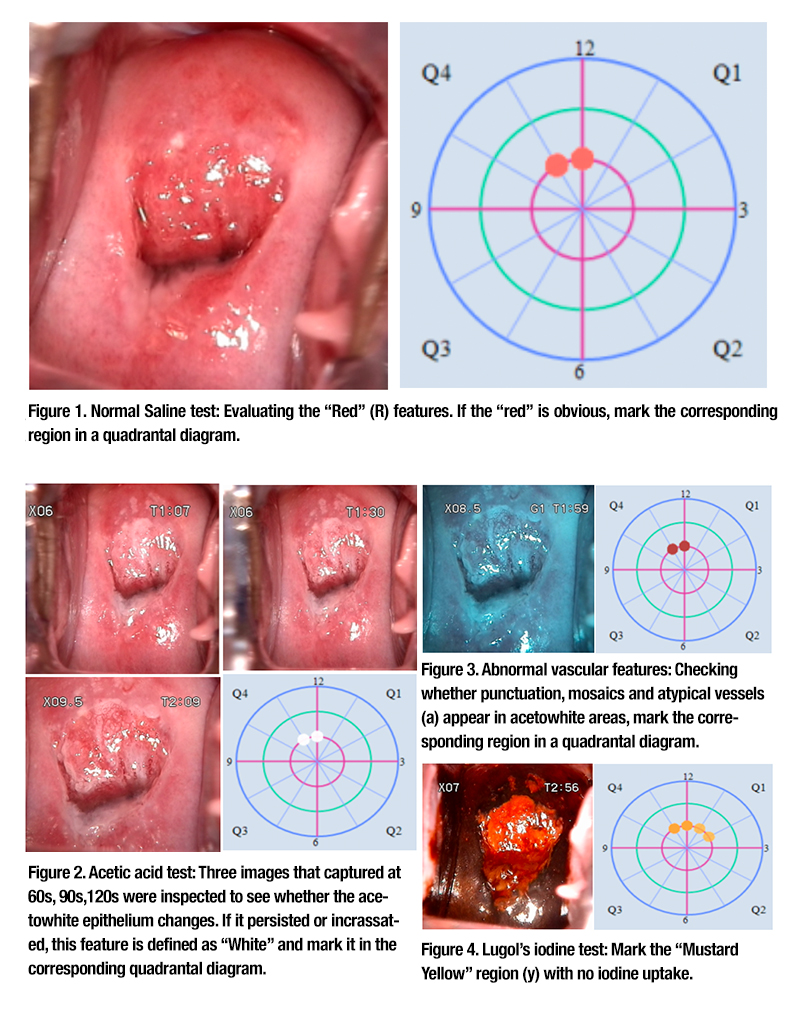 Cervical 2-2.jpg